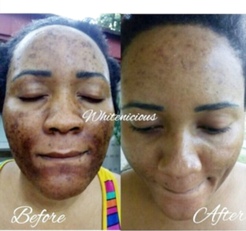 Face Brightening Regimen For Dry Skin Set